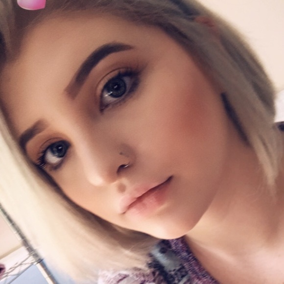 babyscars17